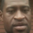 Rubeola